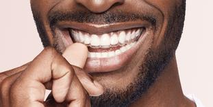 Appareil dentaire aligneur pour adultes