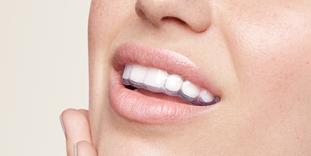 Transparente Knirschschiene