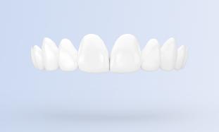 Facettes dentaires et hygiène dentaire