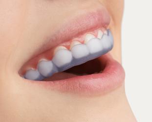 Night guard for teeth