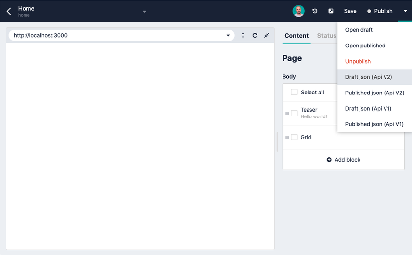 Storyblok editing capabilities