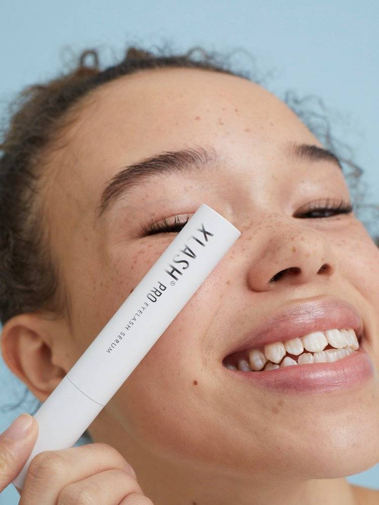 How our partner set up Xlash up for global eCommerce expansion