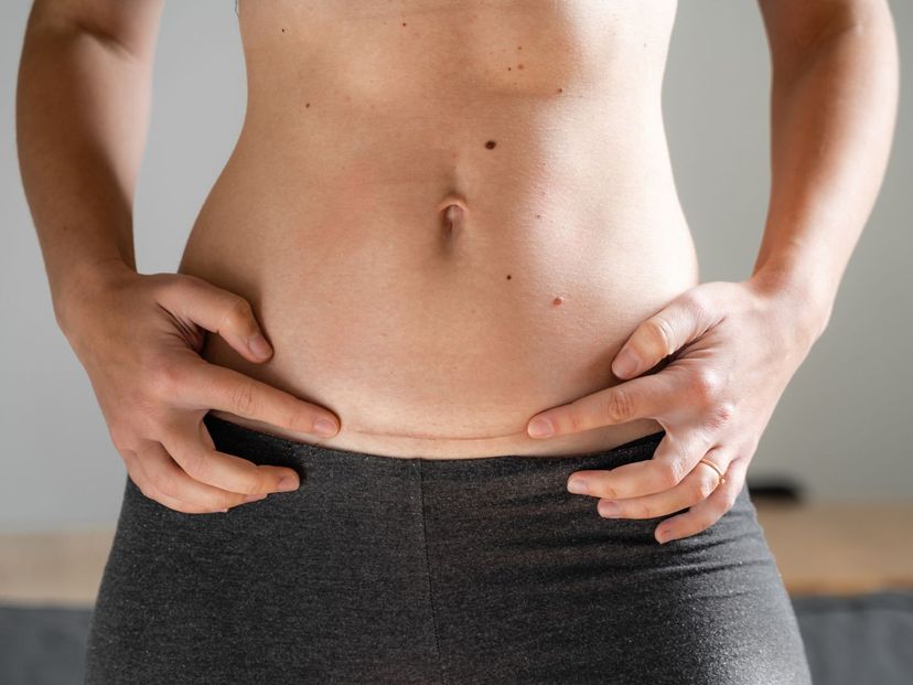 C-Sections and Recovering from Them