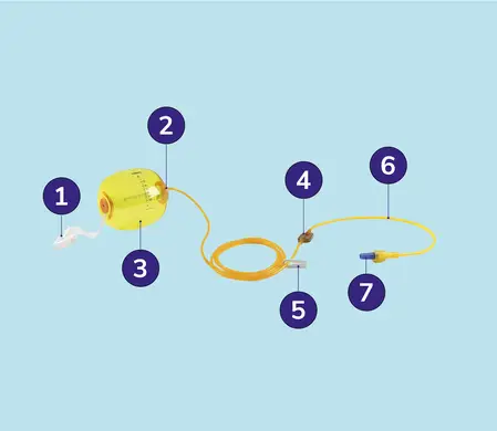 De onderdelen van de AutoFuser K