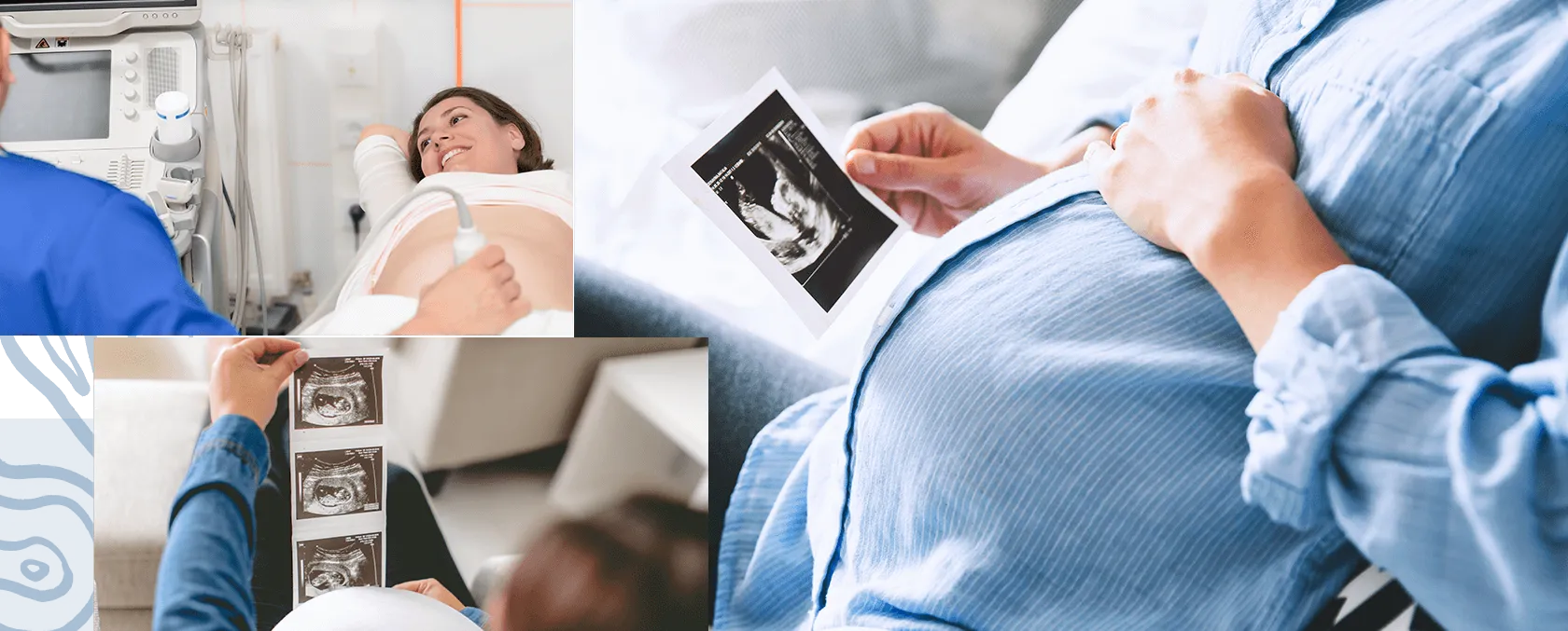 Ultrasound diagnosis