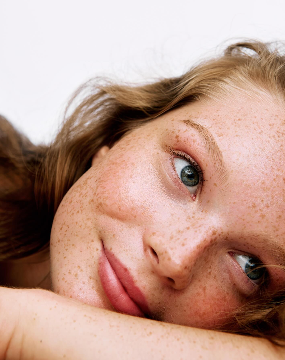 Close-up of a person with freckles and light brown hair, resting their head on their arm, gazing softly.