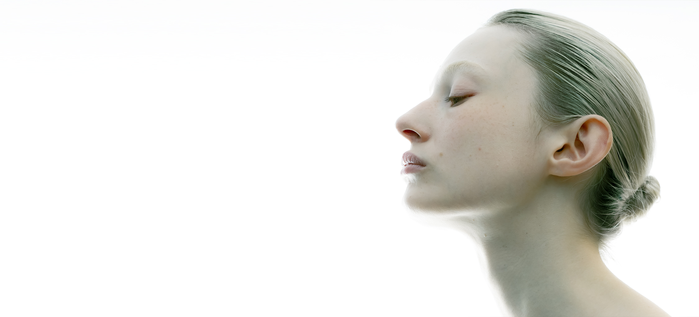 Peaux sujettes au psoriasis — Typology